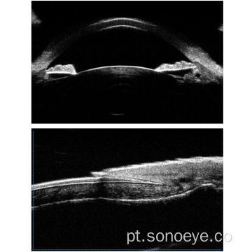 Microscópio de biomicroscopia de ultra-som para os olhos